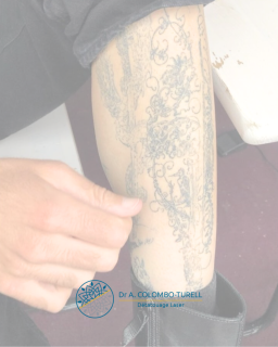 Comment bien entretenir son tatouage pour qu’il vieillisse bien ?