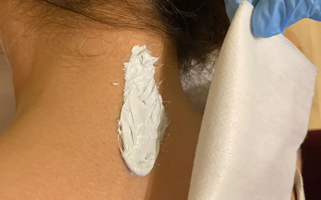 Les soins et conseils post détatouage Metz
