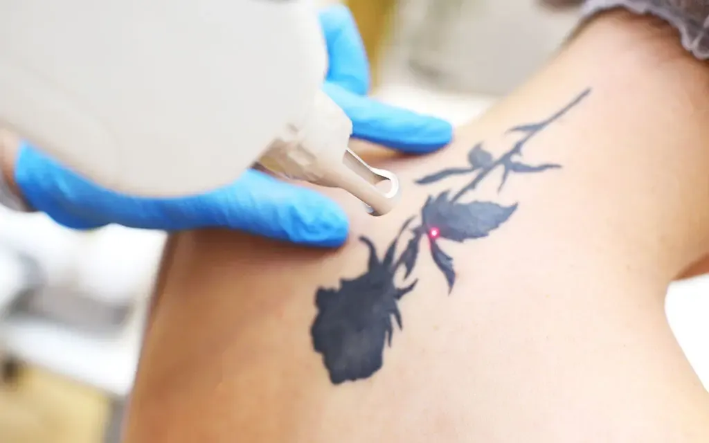 Eclaircissement d'un cover, retouche d’un tatouage Metz et Luxembourg