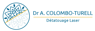 Détatouage laser